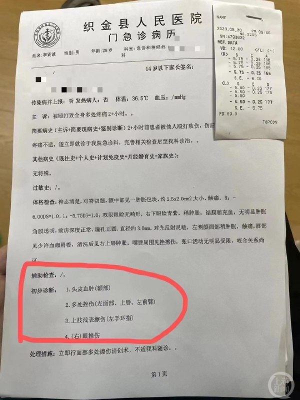 极目新闻记者李贤诚5月30日在贵州织金采访时，被当地派出所警员截车并打伤